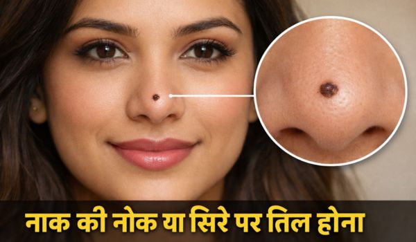 नाक की नोक या सिरे पर तिल होना